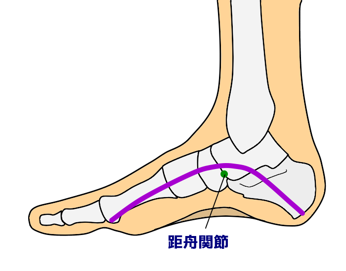 靴の補正について 靴の内部 なぜなに 装具 まとめ