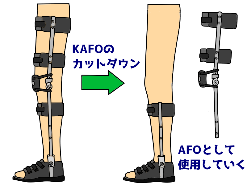 Ptot国家試験解説 長下肢装具の構成要素 なぜなに 装具 まとめ