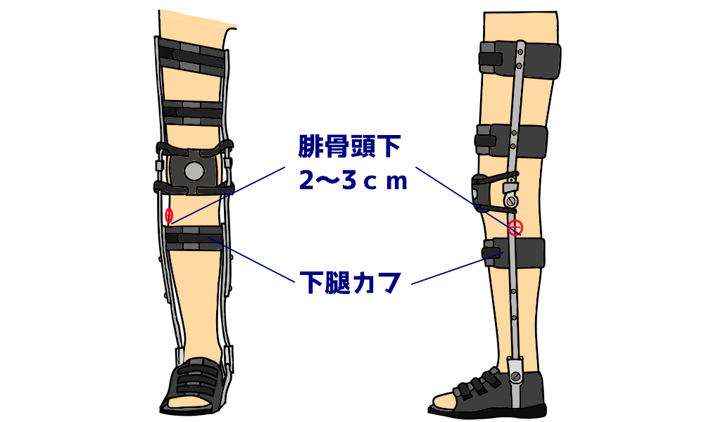 PTOT国家試験解説 長下肢装具の構成要素 | なぜなに。装具 まとめ