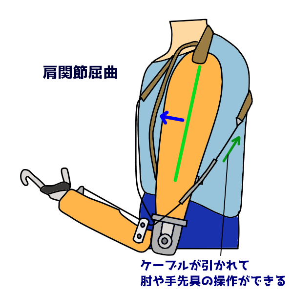 能動義手の操作　肩屈曲による肘継手屈曲と手先具開閉