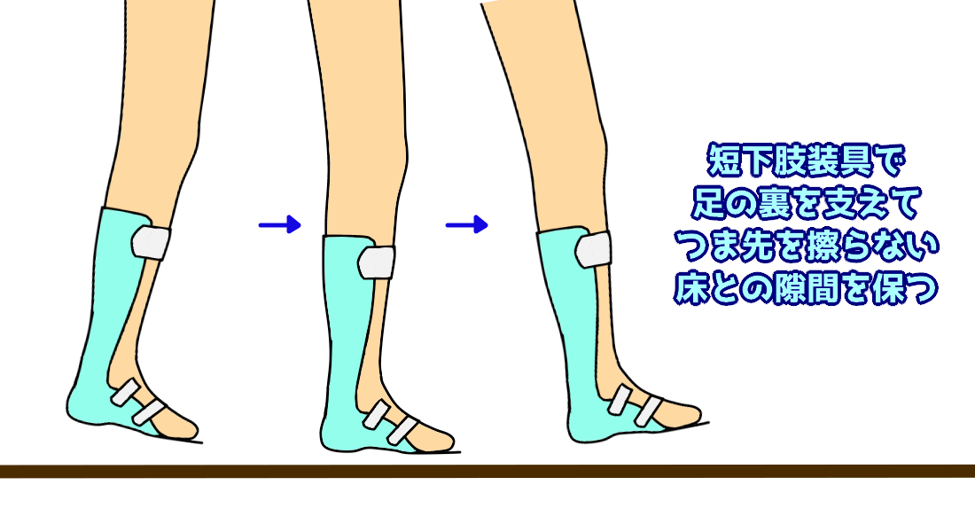 下垂足装具 軽量バランス装具 片麻痺用 L-右足 ウォーキング 脳卒中用靴
