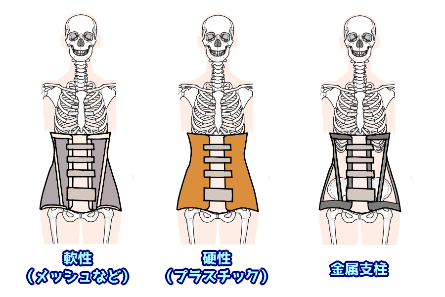 よく使用されている 「コルセット」の種類について | なぜなに。装具