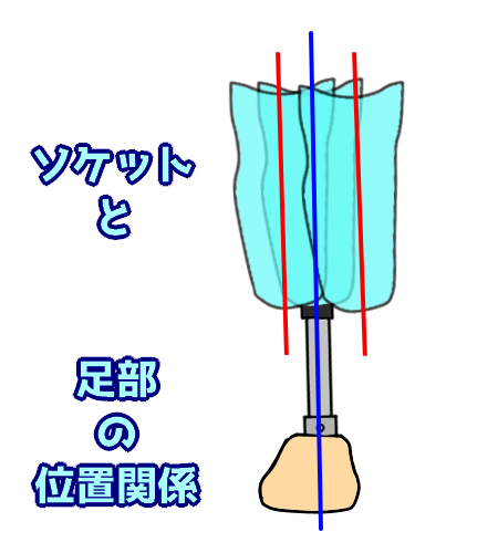 第56回理学療法士国家試験解説AM-39 下腿義足のソケット初期角度 
