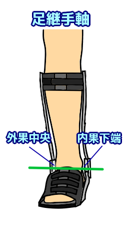第56回理学療法士国家試験解説PM-06 両側支柱付短下肢装具の適合 