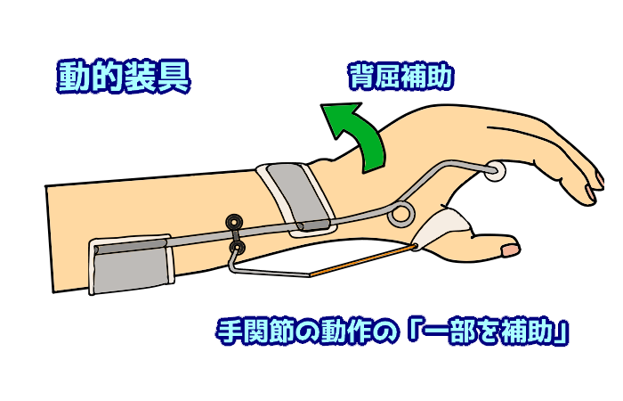 コレクション ハーネス駆動式把持装具 製作