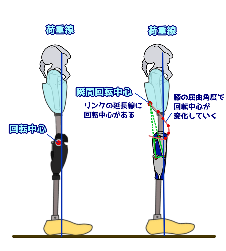第52回理学療法士国家試験解説PM-06 大腿義足を構成する部品 | なぜな