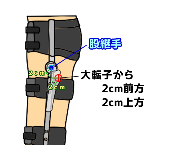 第52回理学療法士国家試験解説PM-30 下肢装具の適合チェックポイント