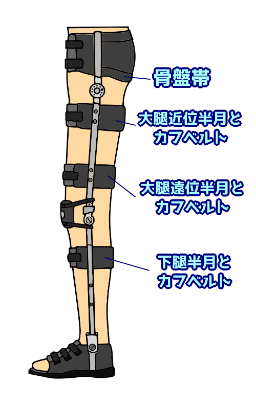 第52回理学療法士国家試験解説PM-30 下肢装具の適合チェックポイント | なぜなに。装具 まとめ