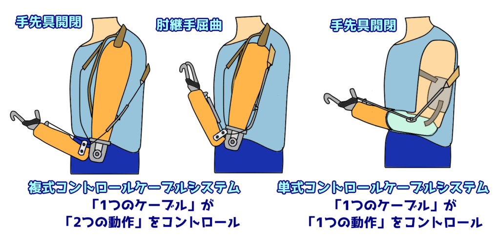 義肢学 PT52-PM13.jpg.webp